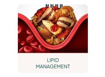 LIPID MANAGEMENT